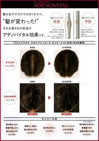 Adenovital Scalp Essence 180ml Hair Growth Solution by Shiseido Pro 