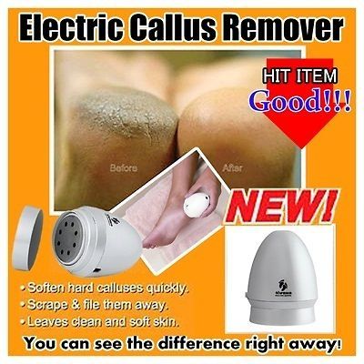 foot callus remover